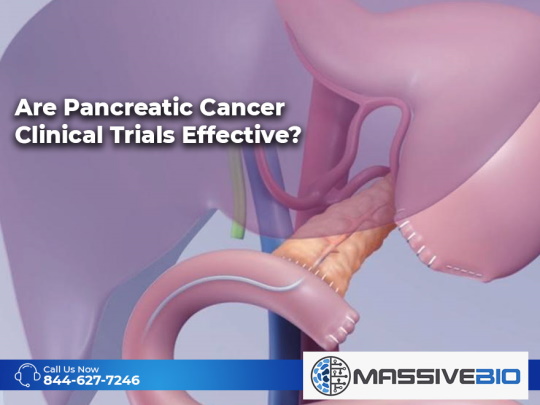 are pancreatic cancer clinical trials effective 01