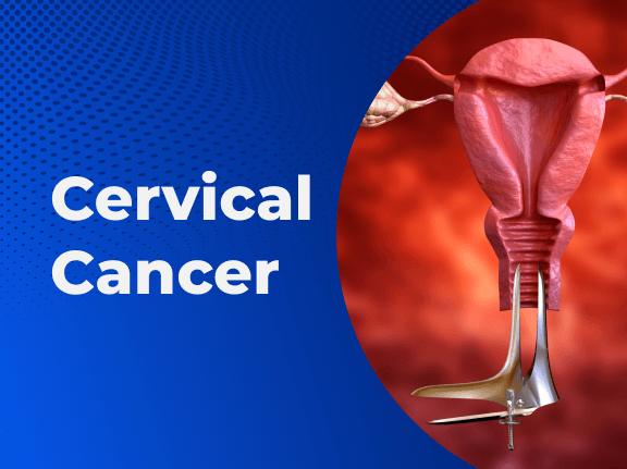 Cervical Cancer 01