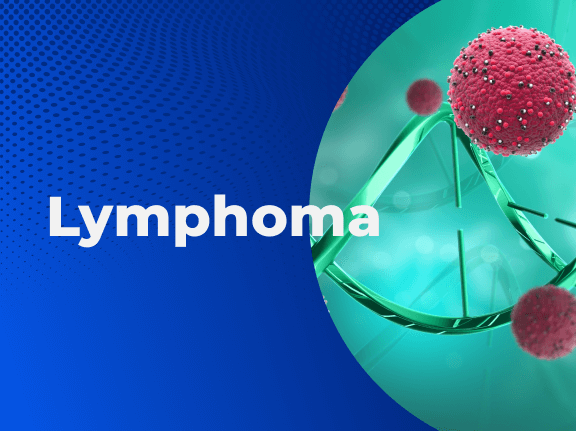 Lymphoma Blog 01