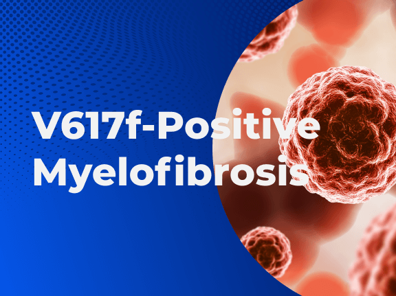 V617f Positive Myelofibrosis 01