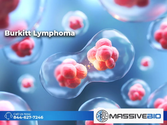 burkitt lymphoma 01