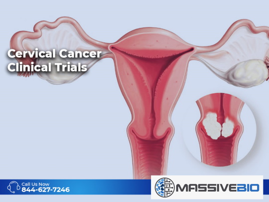 cervical cancer clinical trials 01