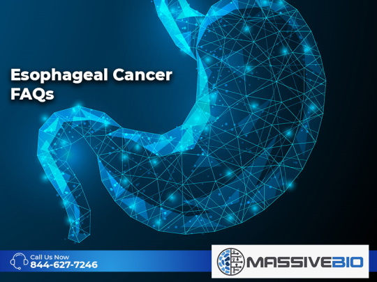 esophageal cancer faqs 01