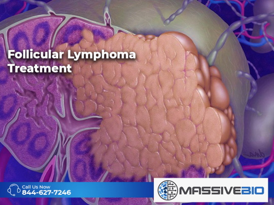 follicular lymphoma treatment 01