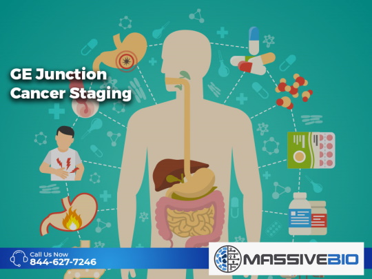 ge junction cancer staging 01