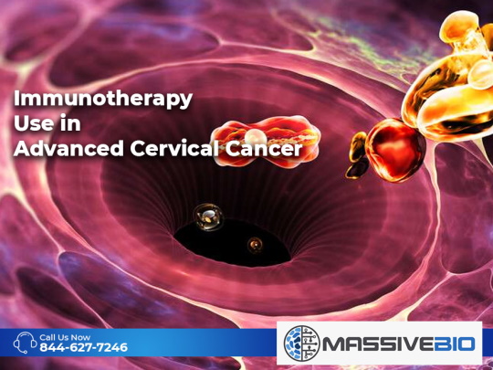 immunotherapy use in advanced cervical cancer 01