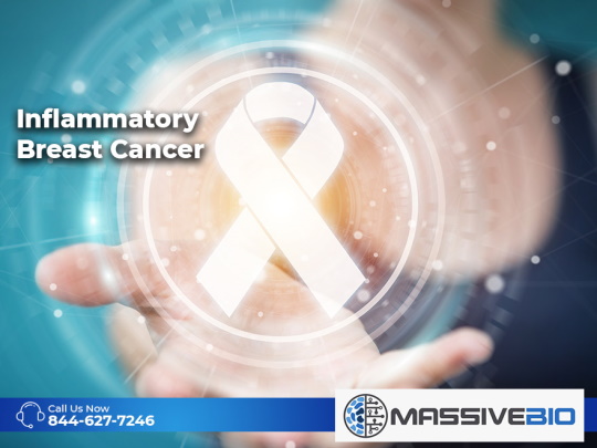 inflammatory breast cancer 01