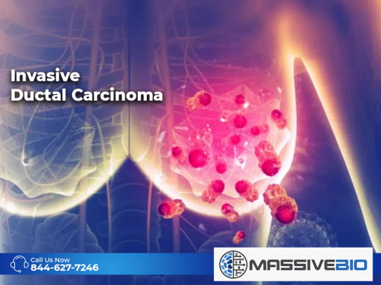 Invasive Ductal Carcinoma