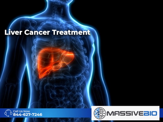 liver cancer treatment 01