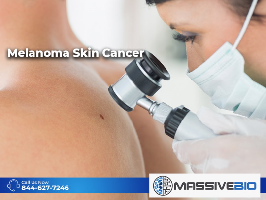 melanoma skin cancer 01