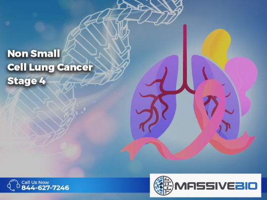 non small cell lung cancer stage 4