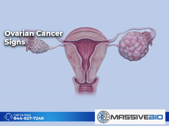 Ovarian Cancer Signs