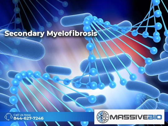 secondary myelofibrosis 01