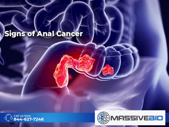 sings of anal cancer 01