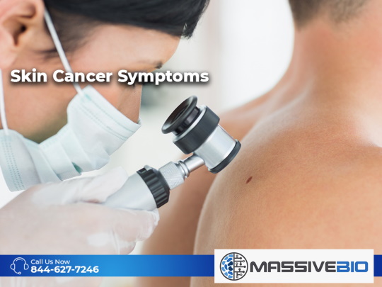 skin cancer symptoms 01