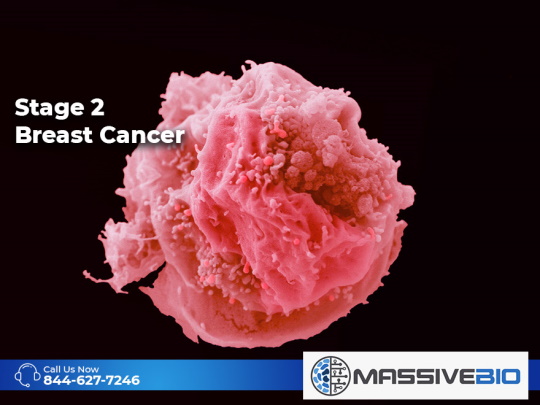 stage 2 breast cancer 01