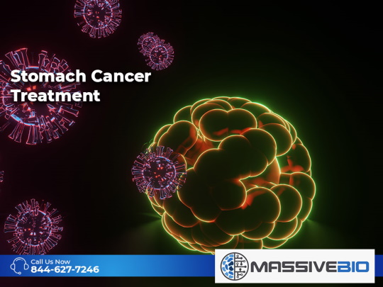 stomach cancer treatment 01