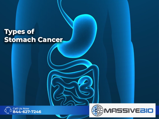 types of stomach cancer 01