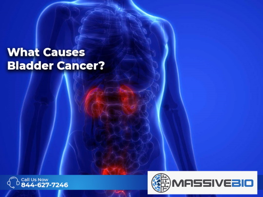 what causes bladder cancer 01