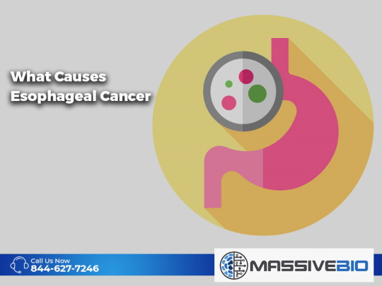 what causes esophageal cancer 01