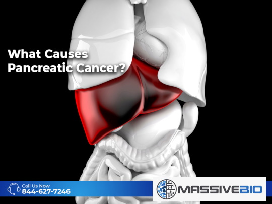 what causes pancreatic cancer 01