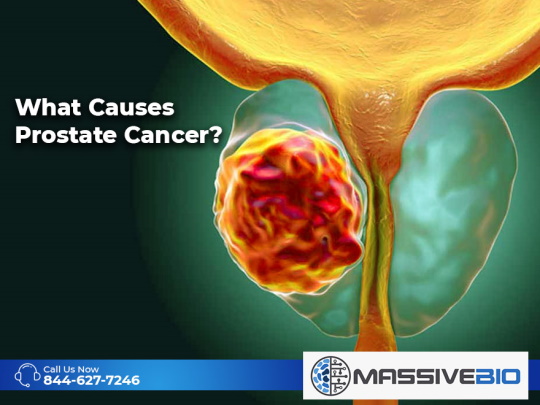 What Causes Prostate Cancer?