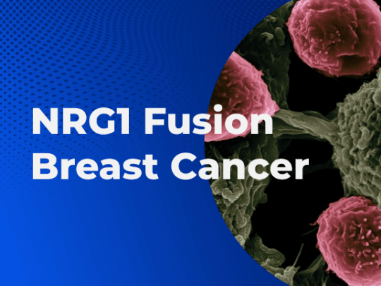NRG1 Fusion Breast Cancer 01