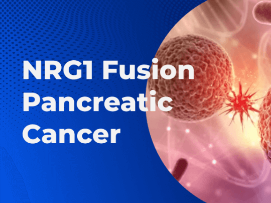 NRG1 Fusion Pancreatic Cancer 01