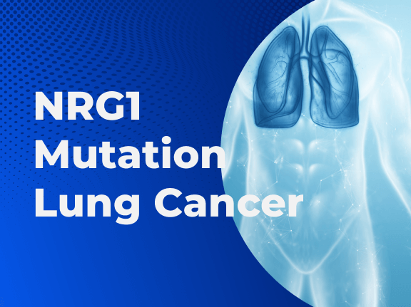 NRG1 Mutation Lung Cancer 01