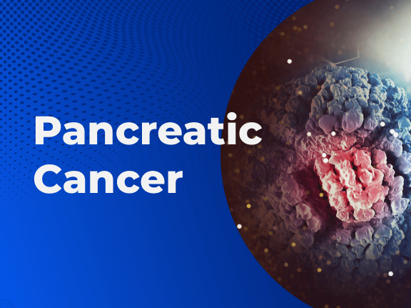 Pancreatic Cancer 01