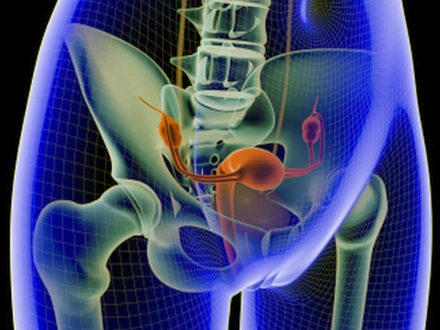Locally Advanced Cervical Cancer
