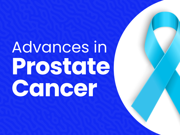 Advances in Prostate Cancer Treatment 2