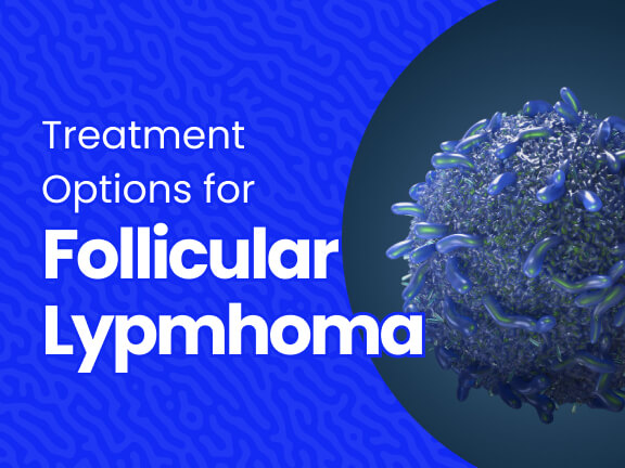 What Are the Treatment Options For Follicular Lymphoma?