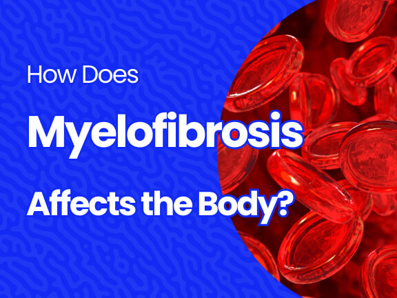 How Does Myelofibrosis Affects the Body?
