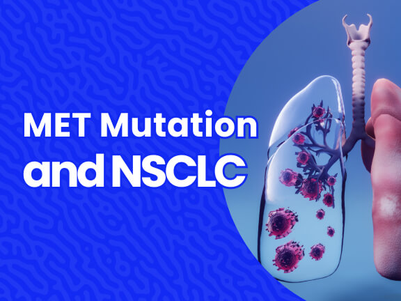 MET Mutation and Non-Small Cell Lung Cancer