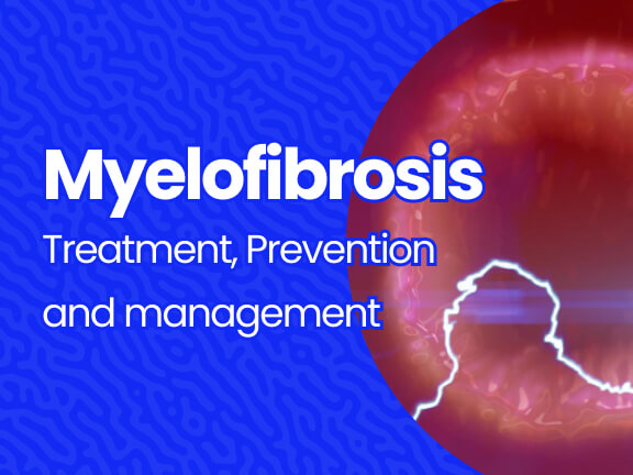 Myelofibrosis; Treatment, Prevention & Management