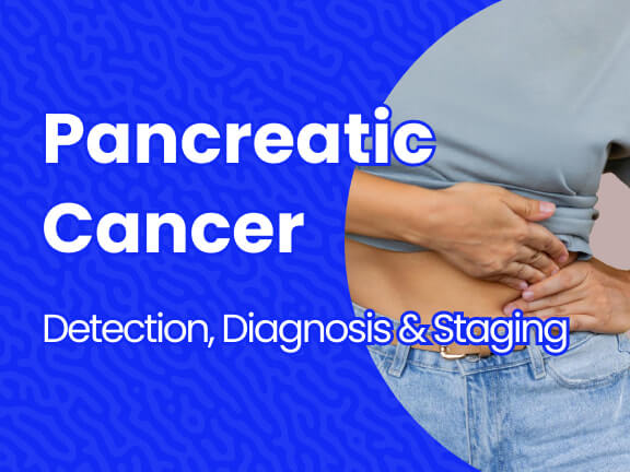 Pancreatic Cancer Detection, Diagnosis, and Staging