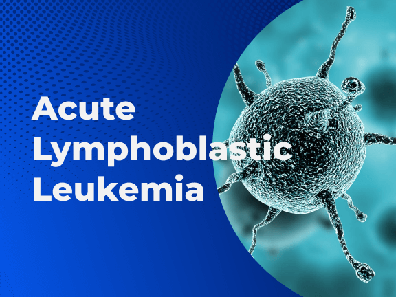 Acute Lymphoblastic Leukemia1