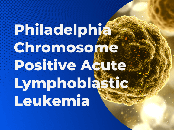 Philadelphia Chromosome Positive Acute Lymphoblastic Leukemia 01