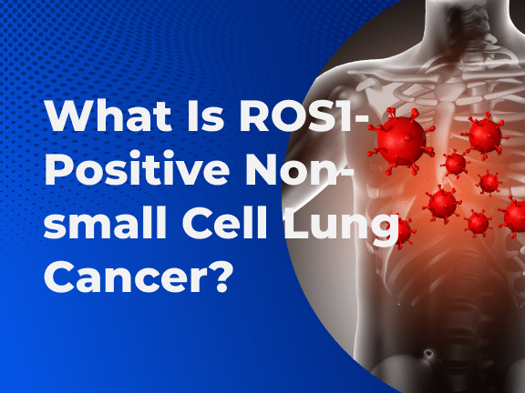 What Is ROS1 Positive Non small Cell Lung Cancer