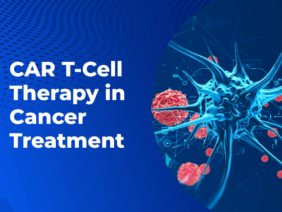 CAR T Cell Therapy in Cancer Treatment 01