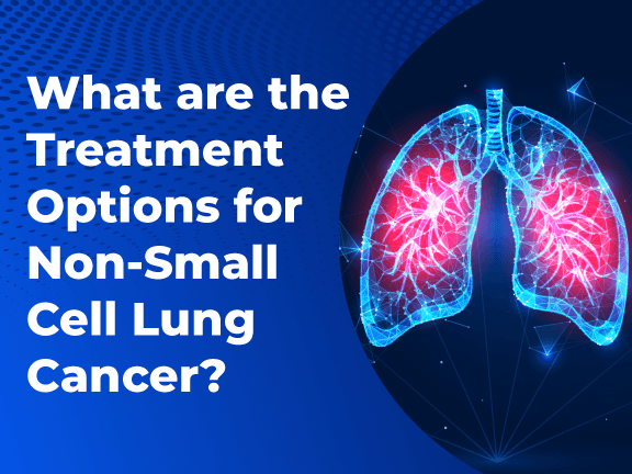 What are the Treatment Options for Non Small Cell Lung Cancer r 01