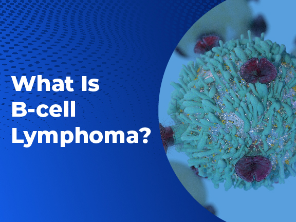 B Cell Lymphoma v01