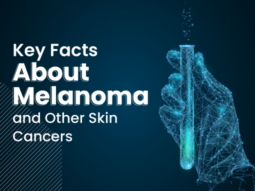 Key Facts About Melanoma and Other Skin Cancers