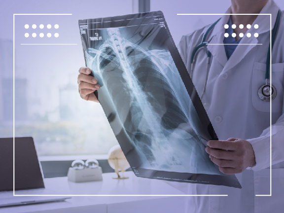 What is ROS1-Positive Lung Cancer?
