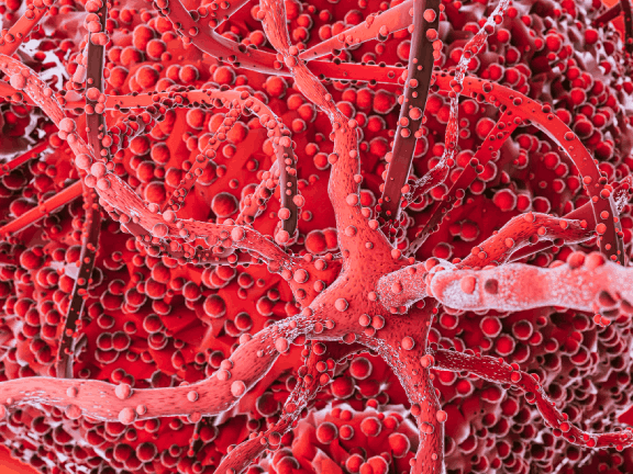 myelofibrosis clinical trials