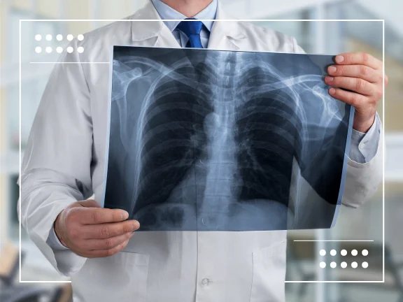 metastatic nsclc 1