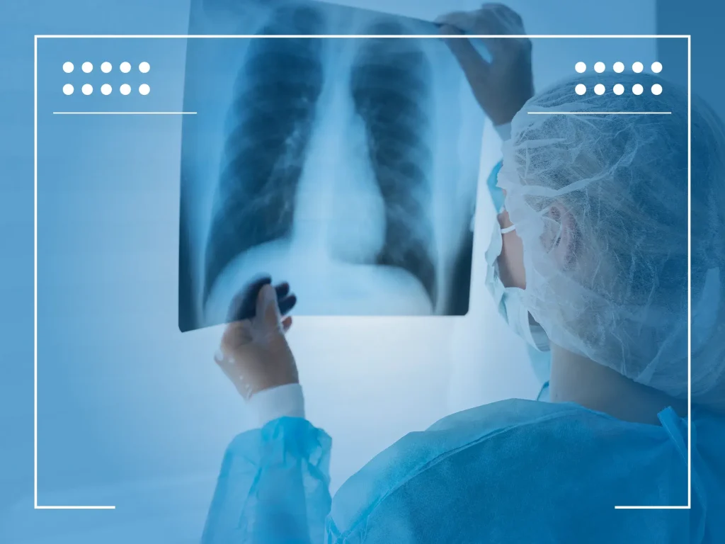 lung cancer treatment 7