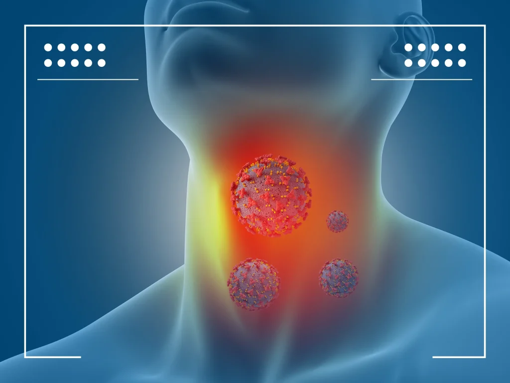 linfoma celulas b 01