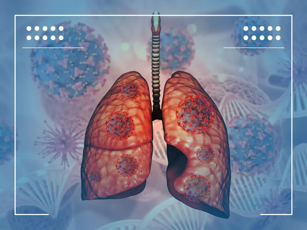 adenocarcinoma metastatico 001 1